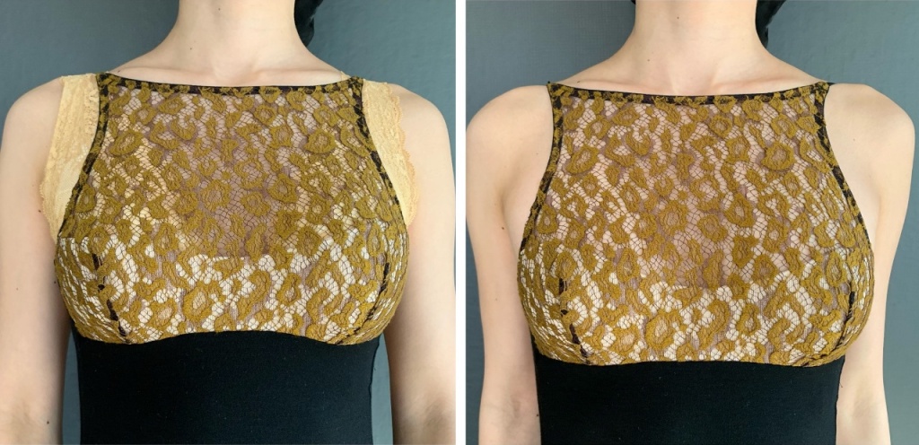 左：ブラ着用 右：ボディのみ着用の画像