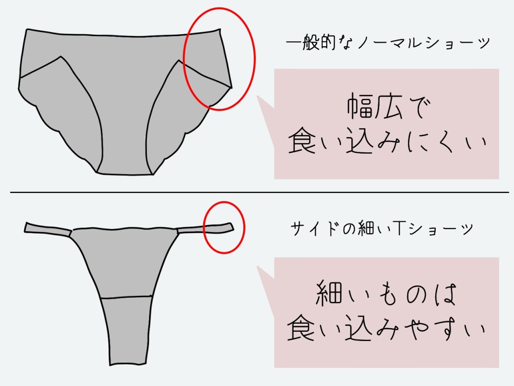 サイドの食い込み比較画像