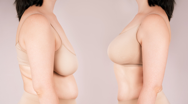 バストの「老け」を撃退！30～40代から気をつけたい垂れや削げへの対策